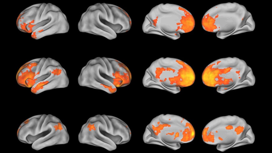 brain scans colorful